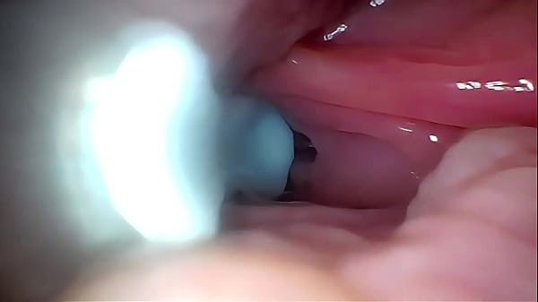Image Semen in Cervix Wide Stretching Pussy Endoscope!