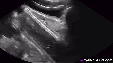 Image Alex Gonz couldn&rsquo_t believe that Legrand Wolf's meat was almost as big as his forearm