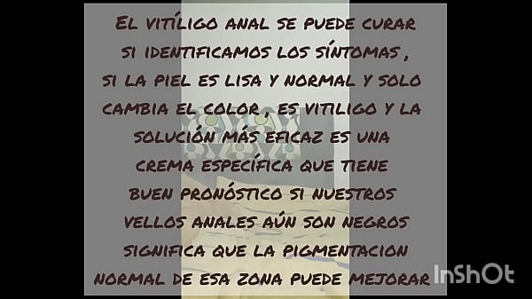 Image Tutorial del ano con vit&iacute_ligo , me di&oacute_ verg&uuml_enza este video pero es para quienes padecen lo mismo
