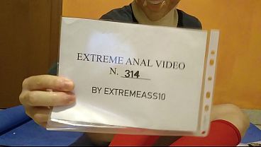 Image A bike pedal in my ass (bizarre anal insertions)